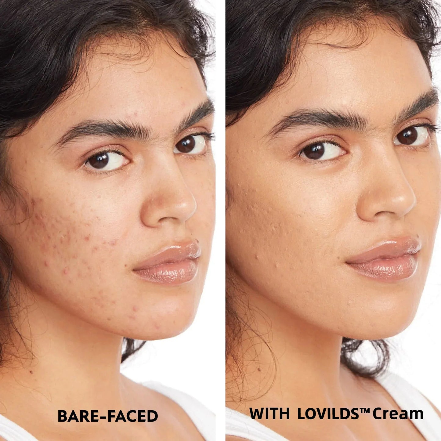 LOVILDS™ Cream - Face & Body Perfector