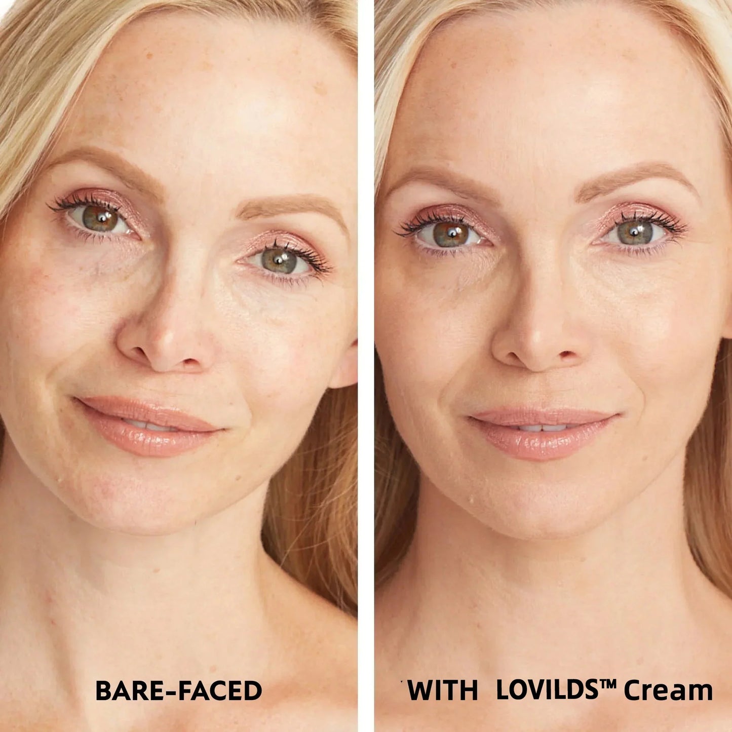 LOVILDS™ Cream - Face & Body Perfector