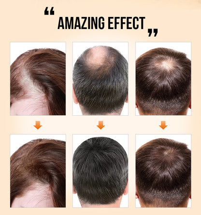 BBOJI™ Natural Hair Growth Oil (⏰Limited time discount last 30 minutes⏰)