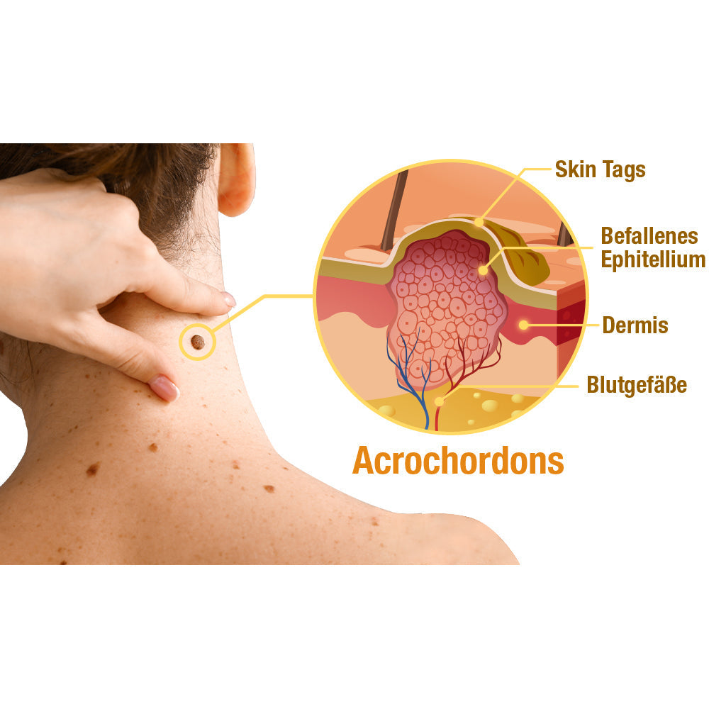 AQA™ TagRecede Bienengift Behandlungs spray