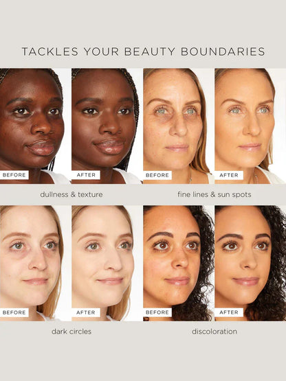 LOVILDS™ Cream - Face & Body Perfector