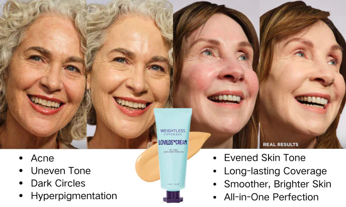 LOVILDS™ Cream - Face & Body Perfector