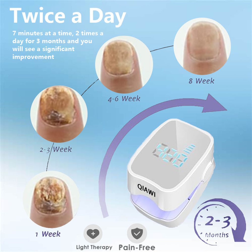🔥(Official Mall)💖QIAWI™ Revolutionary High-Efficiency Light Therapy Device For Toenail Diseases-🗽Made and Shipped from USA 🔥